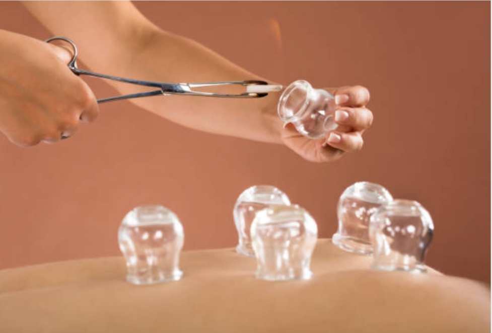 Bekam: Apa Saja Fungsinya ?