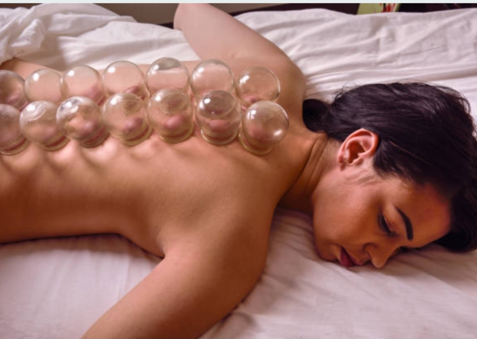 Bekam: Apa Saja Fungsinya ?